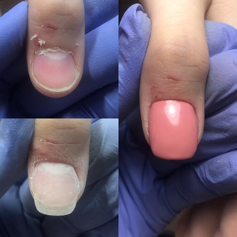 thumb