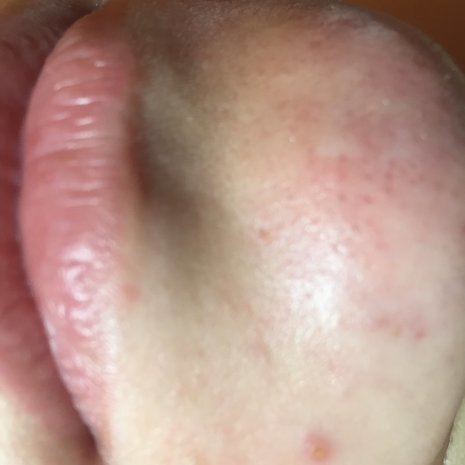 thumb
