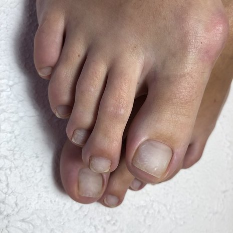 thumb