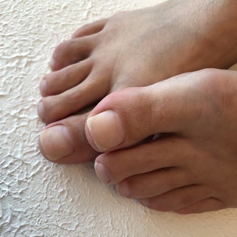 thumb