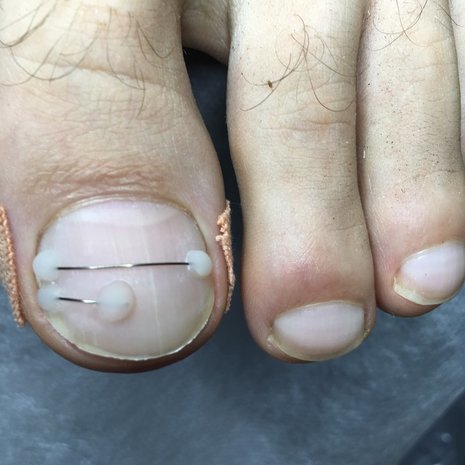 thumb