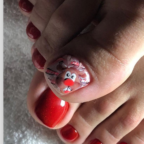 thumb