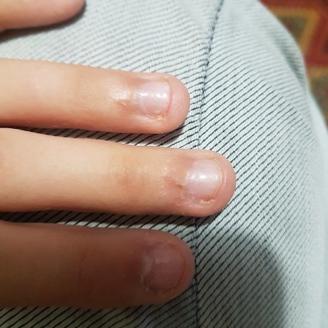 thumb