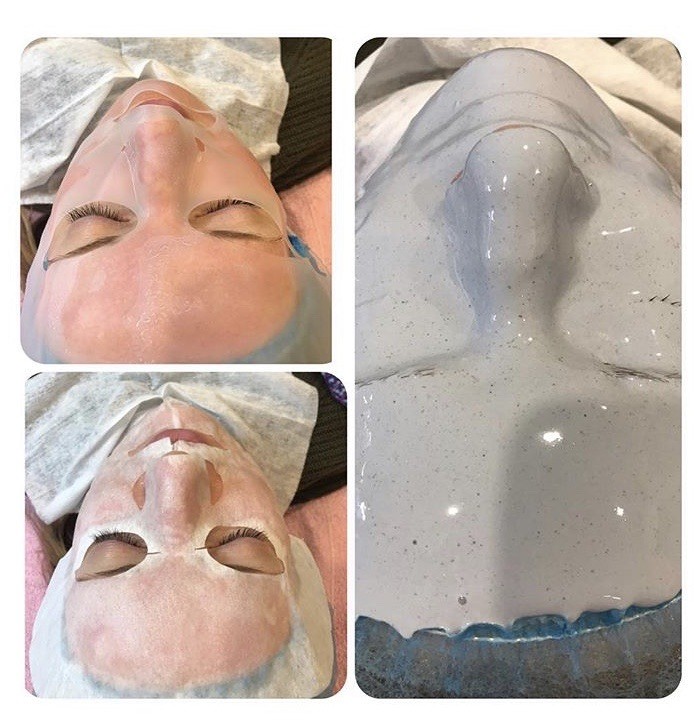 Альгинатная маска до и после. Альгинатная маска у косметолога. Альгинатная маска для лица до и после. Альгинатная маска после пилинга. Альгинатная маска в бандажной технике.