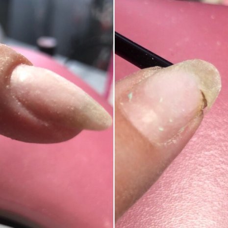 thumb