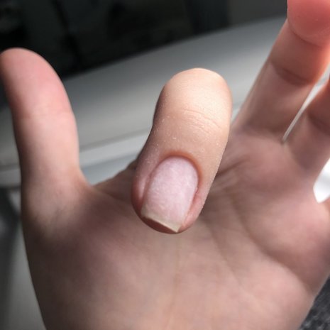 thumb