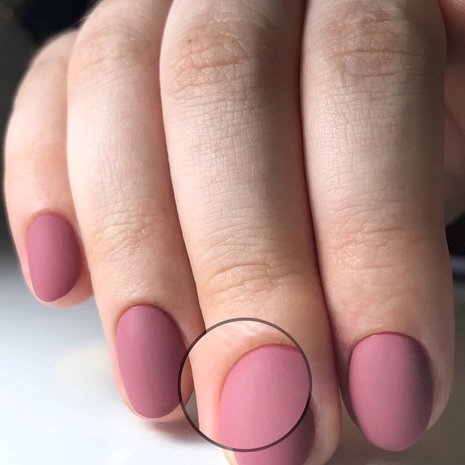 thumb