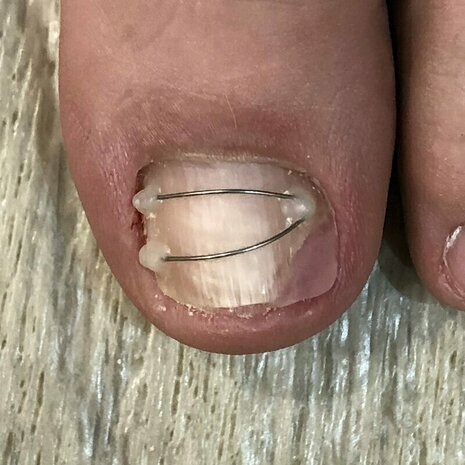 thumb