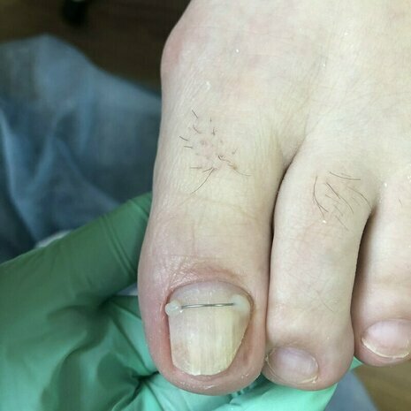 thumb