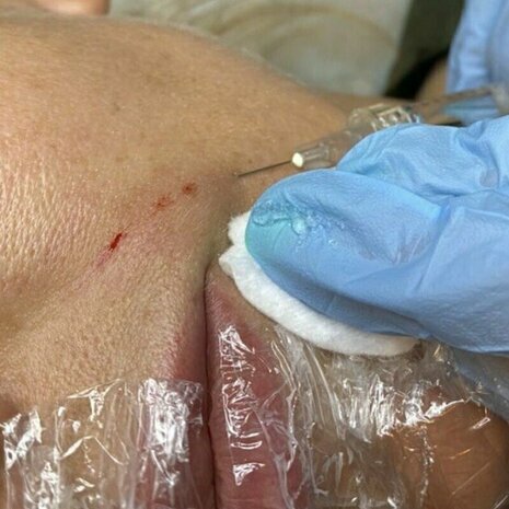 thumb