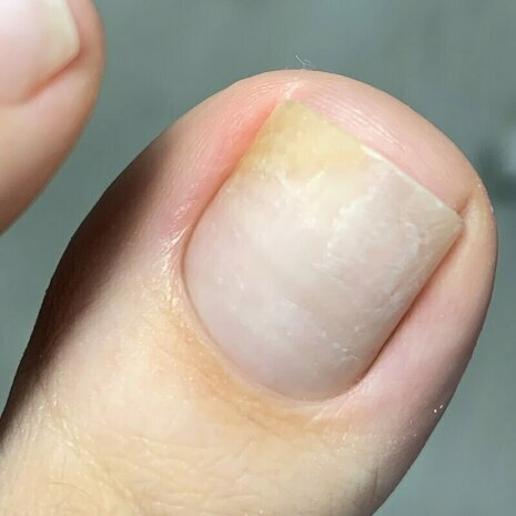 thumb