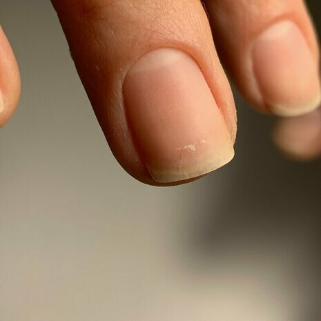 thumb