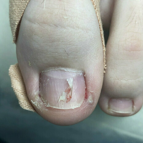 thumb