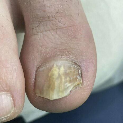 thumb