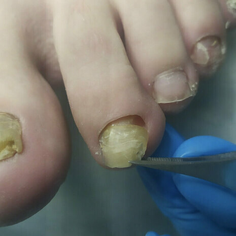 thumb