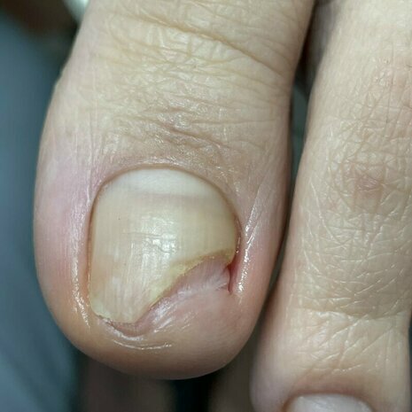 thumb