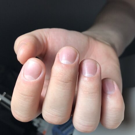 thumb