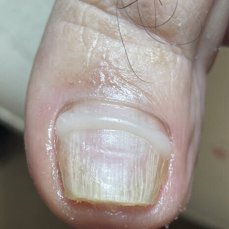 thumb