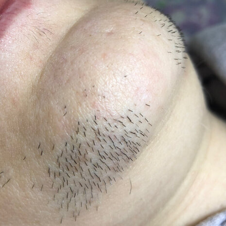 thumb