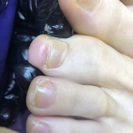 thumb