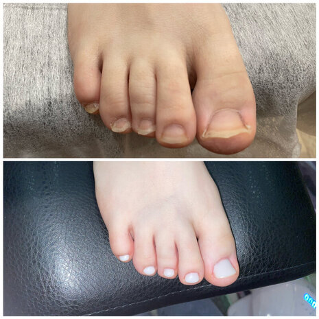 thumb