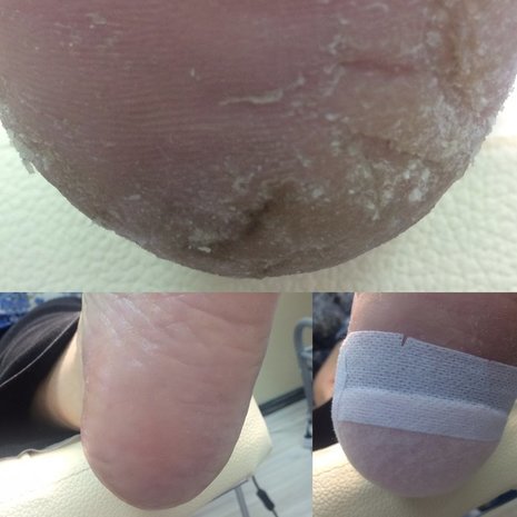 thumb