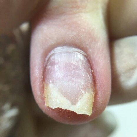 thumb