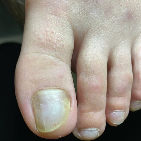 thumb
