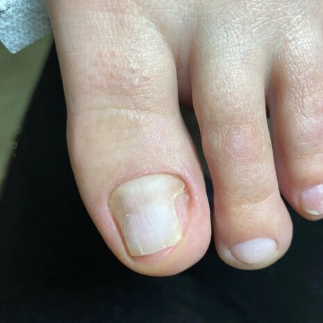 thumb