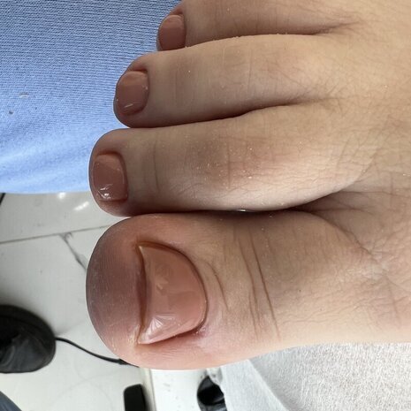 thumb