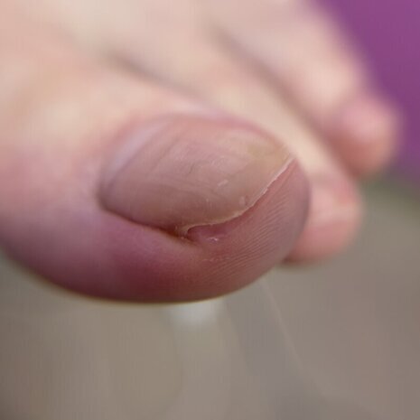 thumb