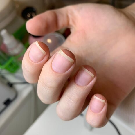 thumb