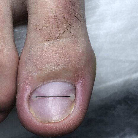 thumb