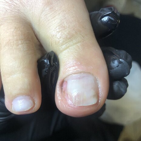 thumb