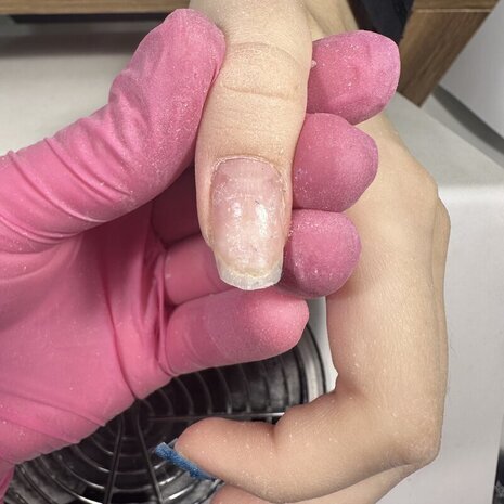 thumb