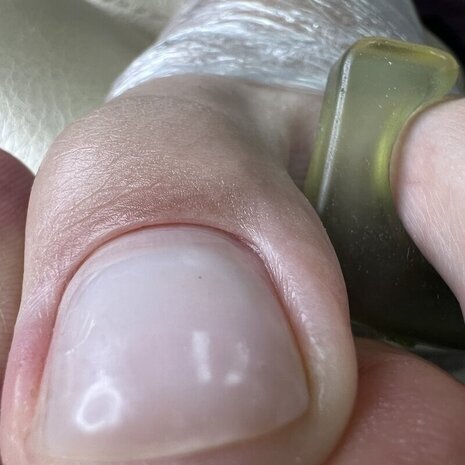 thumb