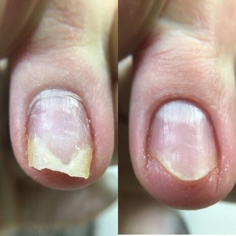 thumb