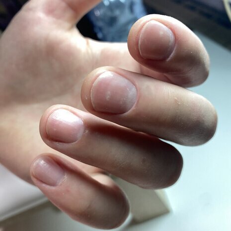 thumb
