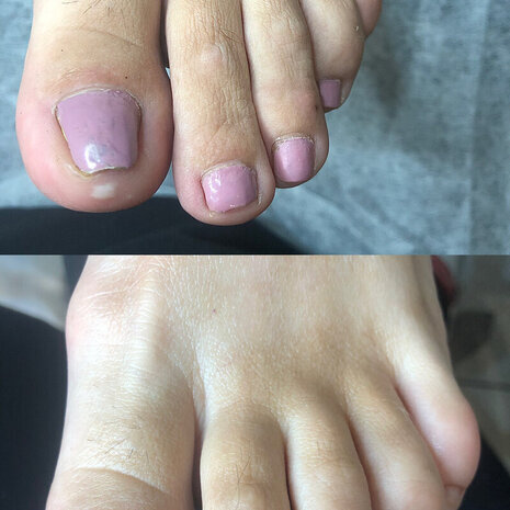 thumb