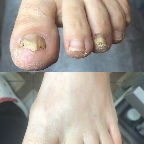 thumb