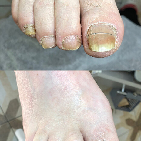 thumb