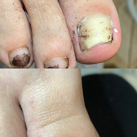 thumb
