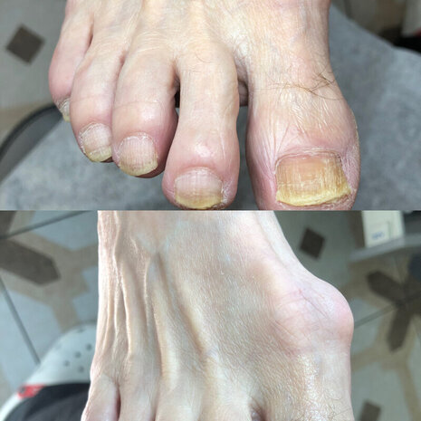 thumb