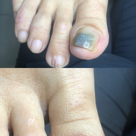 thumb