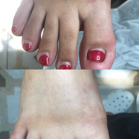 thumb