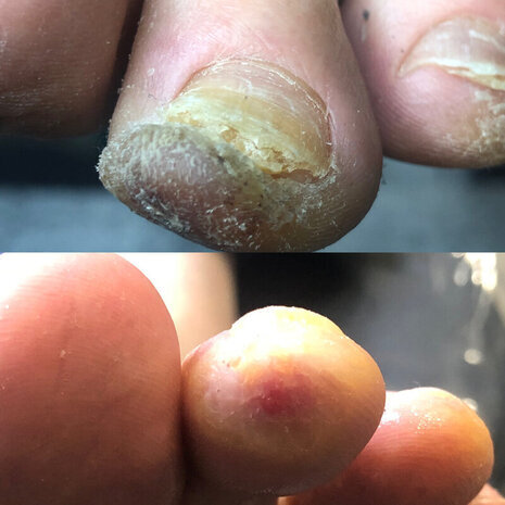 thumb
