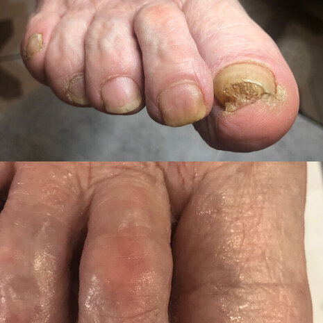 thumb