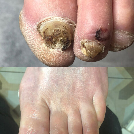 thumb