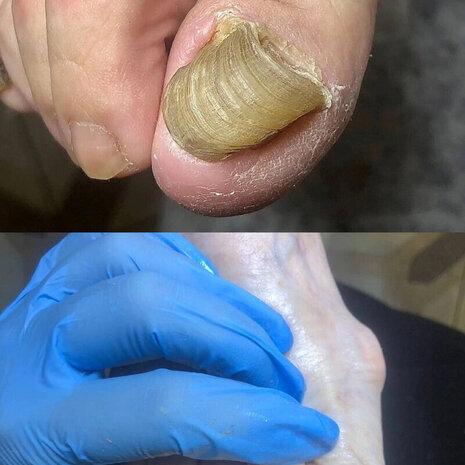 thumb