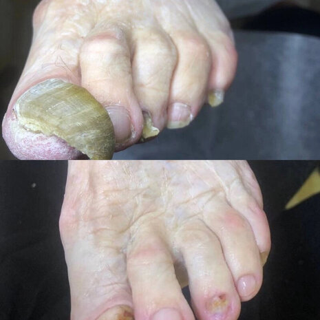 thumb